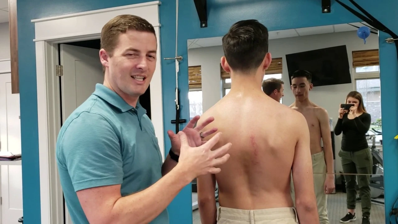Can Physical Therapy Prevent Scoliosis From Getting Worse?